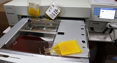 Kızılay'a çağrı: "COVID-19'u ağır geçiren hastalar için immun plazma temin edilmeli"