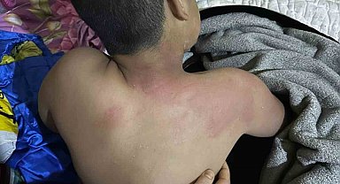 Seçim bürosuna gelen çocuğu kaynar çayla yaktı, tutuklandı