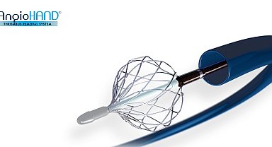 INVAMED'den Akciğer Embolisi tedavisinde etkili çözüm