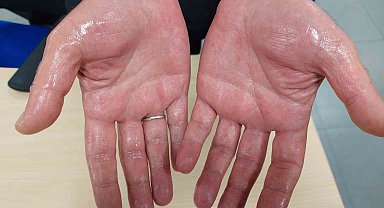 Terlemeye terletmeyen çözüm