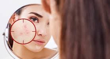 Güzellik Uzmanı Çiğdem Koç: 