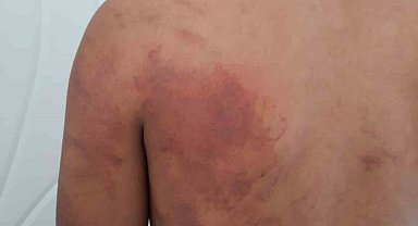 Baba ve amcanın 16 yaşındaki çocuğu zincirle bağlayıp işkence ettiği iddiası