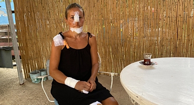 Sokak Köpekleri Anne Ve Kızı Perişan Etti