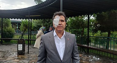 Sağ gözünde yüzde 60 görme kaybı oluştu, yine de şikayetçi olmadı