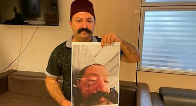 Sosyal medya fenomeni, ev sahibi tarafından darp edildiğini iddia etti