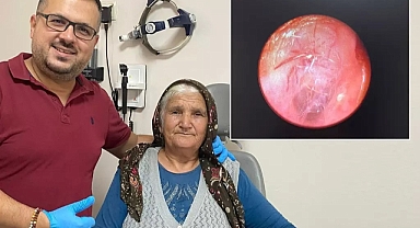 Kulağındaki Hışırtı İçin Hastaneye Gitti... Doktor Gözlerine İnanamadı!