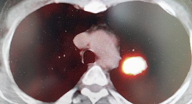 Prof. Dr. Şevket Özkaya: 