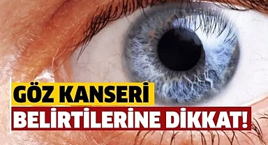Gözde Oluşan Tümöre Dikkat!
