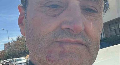 Ankara'da eylem yapan grup başıboş köpeklerin toplanmasına destek veren vatandaşın burnunu kırdı