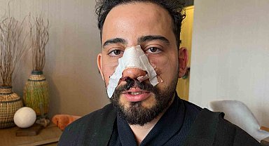 Siparişler geciktiği için gitmek isteyen müşteriye restoran çalışanlarından öldüresiye darp