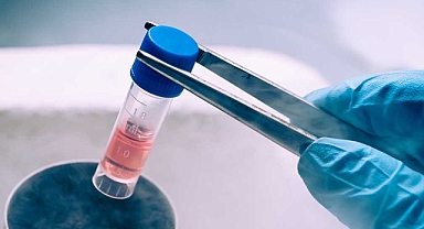 Balıkesir Üniversitesi Akademisyenlerinden Kök Hücre Tedavisinde Önemli Bulgular