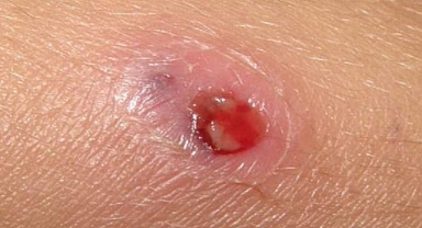 BAÜN’lü Bilim İnsanlarından Chagas Hastalığına Umut Olacak Uluslararası Başarı