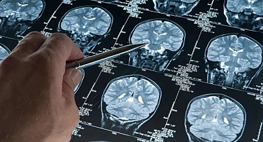 Balıkesir Üniversitesi Akademisyenleri, EMC10 Geninde Nörogelişimsel Bozukluklara Yol Açan Yeni Varyantı Literatüre Kazandırdı