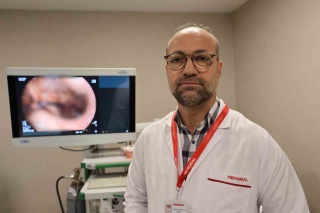 Ameliyatsız Endoskopik Tüp Mide ile Obeziteye Çözüm